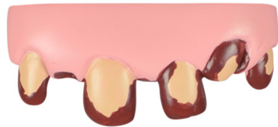 The Bite Kit Funny Teeth