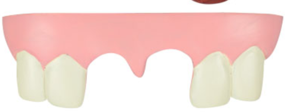 The Bite Kit Funny Teeth