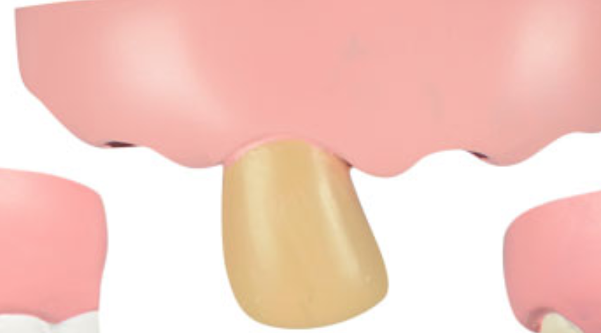 The Bite Kit Funny Teeth