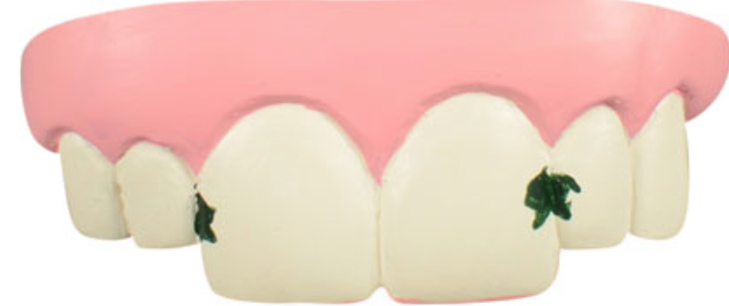 The Bite Kit Funny Teeth